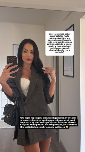 Full leaked Anet slotova private photo