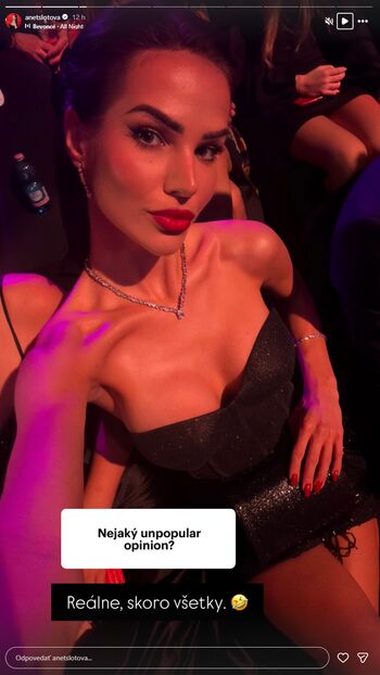 Full leaked Anet slotova private photo