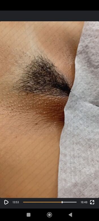 Bronzeamento Natural