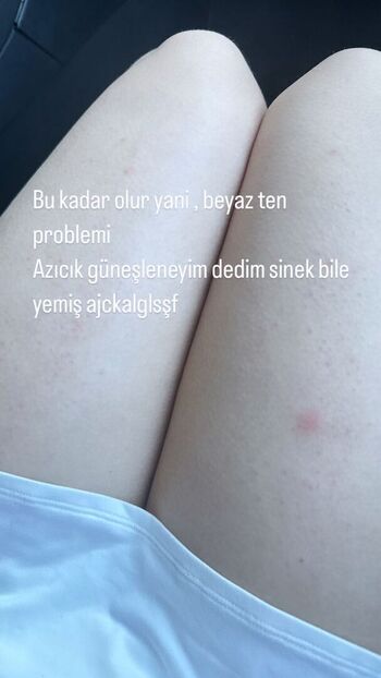 Full leaked Ecbsnn ece basaran private photo