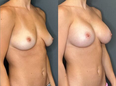 Full leaked Fiona mae private photo