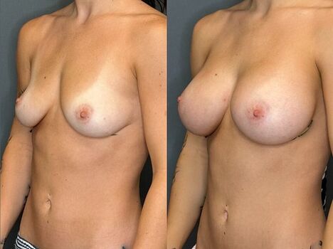 Full leaked Fiona mae private photo