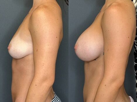 Full leaked Fiona mae private photo