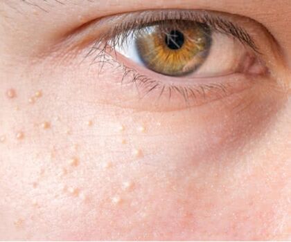 Full leaked I m e m i l i a private photo