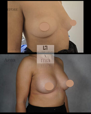 Full leaked Mia femtech private photo