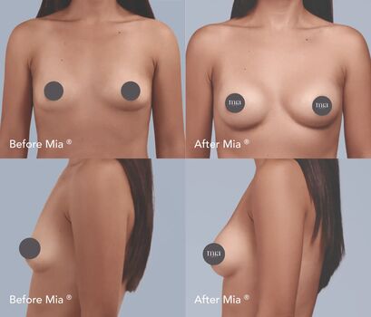 Full leaked Mia femtech private photo