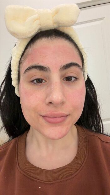 Full leaked Sour patch private photo