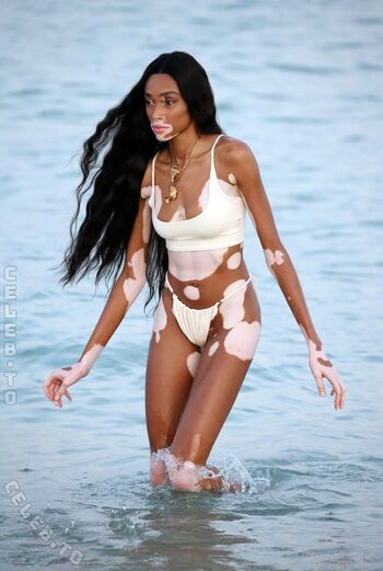 Winnie Harlow