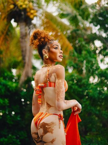 Full leaked Winnie harlow page private onlyfans photo