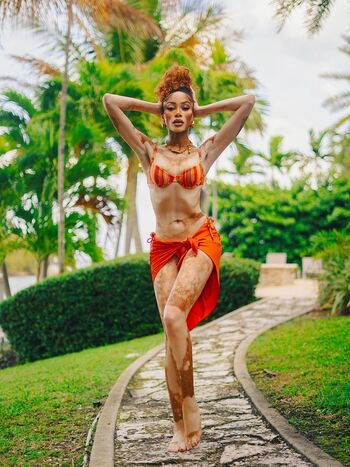 Full leaked Winnie harlow private onlyfans photo